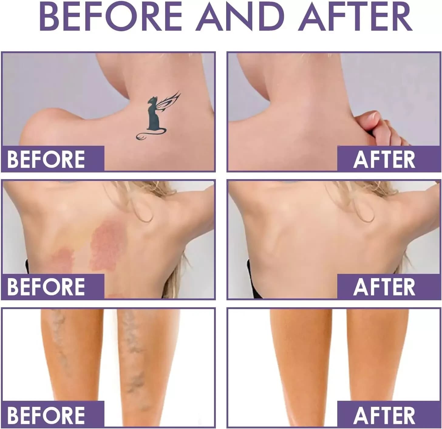Body Concealer - Waterproof Tattoo Cover up and Leg Makeup for Veins| Scars| and view 2