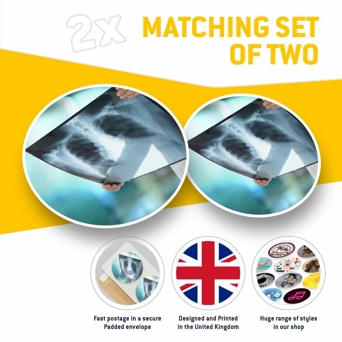 2 x Vinyl Stickers 30cm - Lung X-Ray Radiography Doctor Cool Gift #21814 view 2
