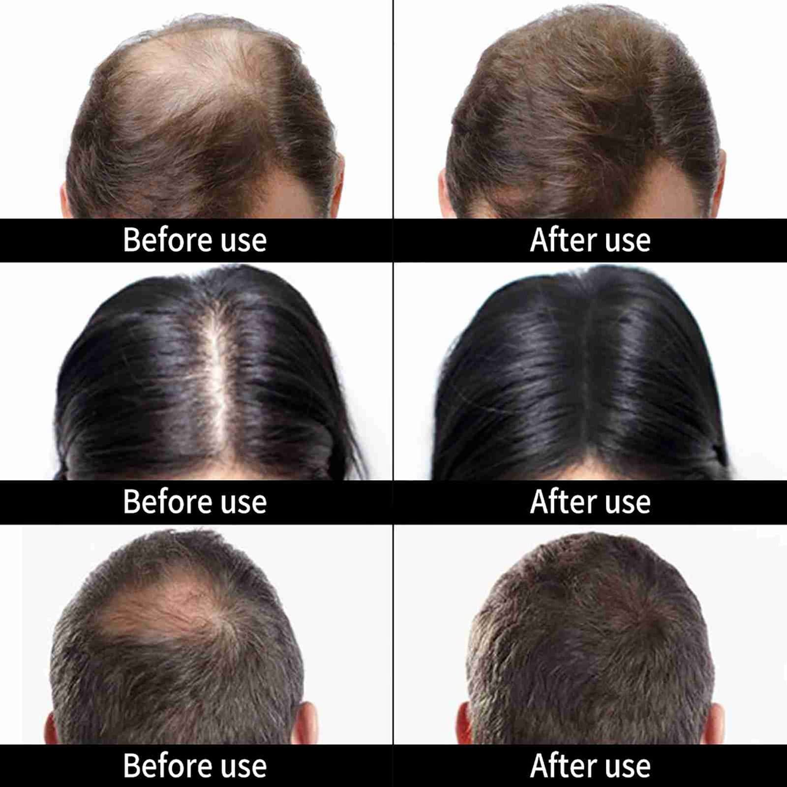Hair Building Fiber Hair Thickener Hair Loss Solution Concealer Hair Fuller view 2