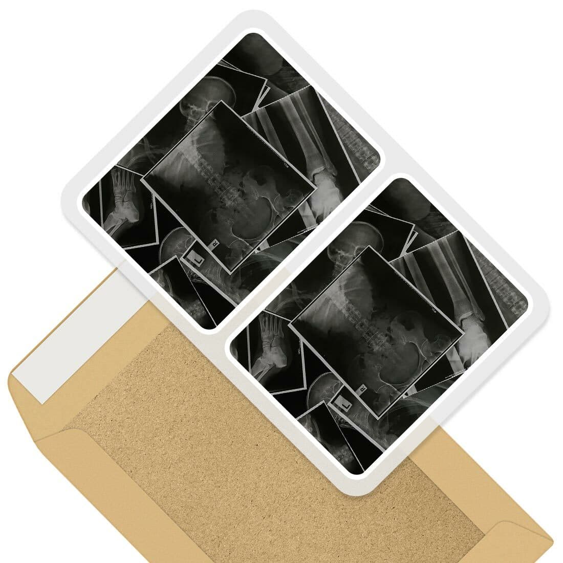 2 x Rectangle Stickers 10cm - X-Ray Spine Pelvis Doctor Radiographer #46479