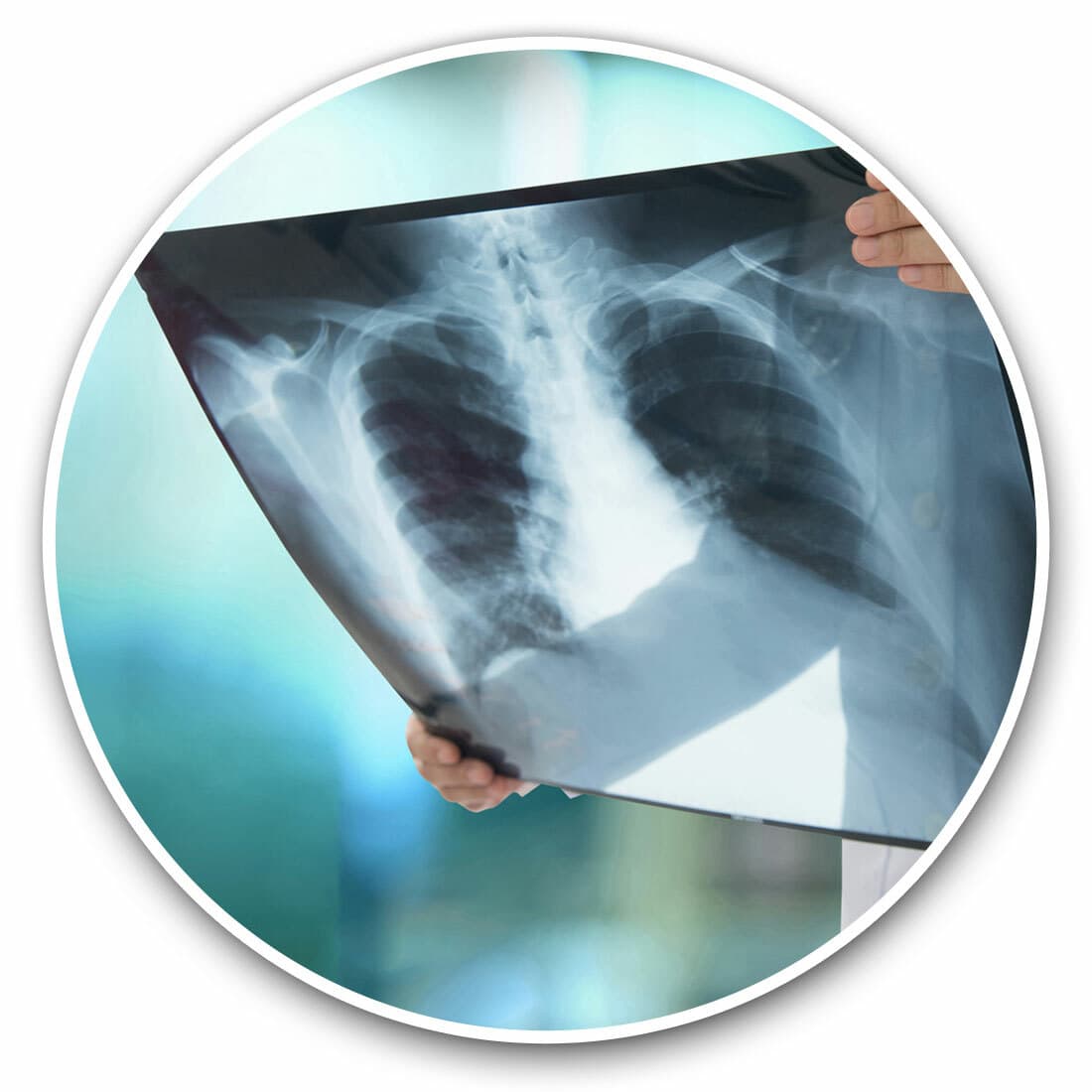 2 x Vinyl Stickers 30cm - Lung X-Ray Radiography Doctor Cool Gift #21814