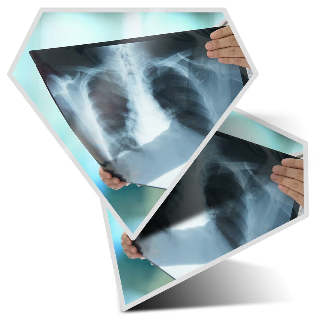 2 x Diamond Stickers 7.5 cm - Lung X-Ray Radiography Doctor  #21814