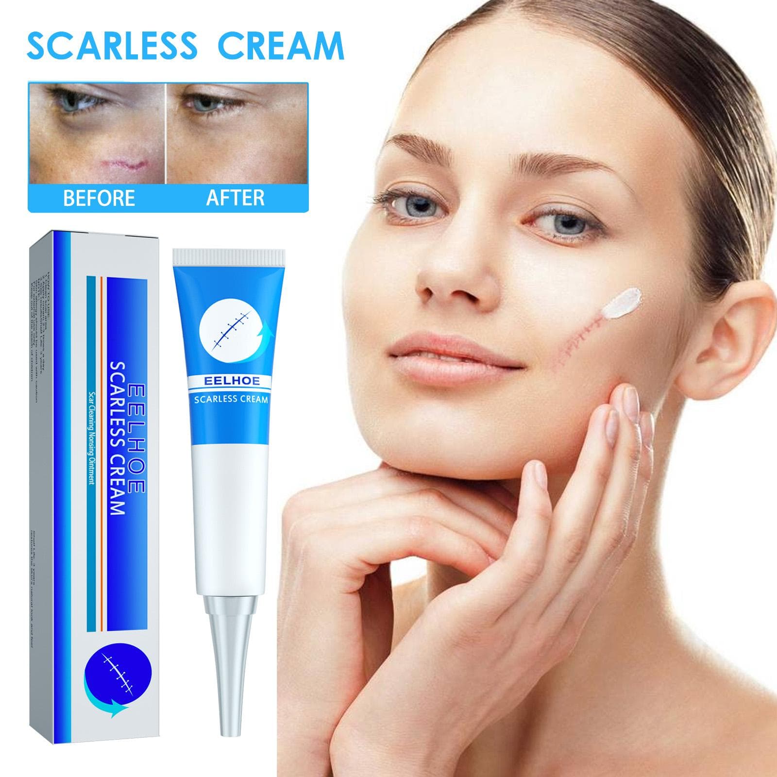 EELHOE Scar Removal Cream, fades scars, repairs wounds, smooths and reduces skin stretch marks and surgical scars, 20g